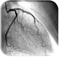 Cardiac Catheterization Cases