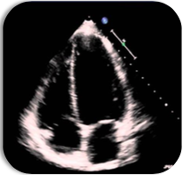 Echocardiography Cases